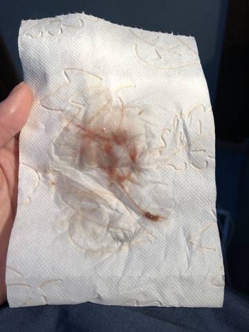 这个是着床出血么 距离月经期还有七天呢 宝宝树