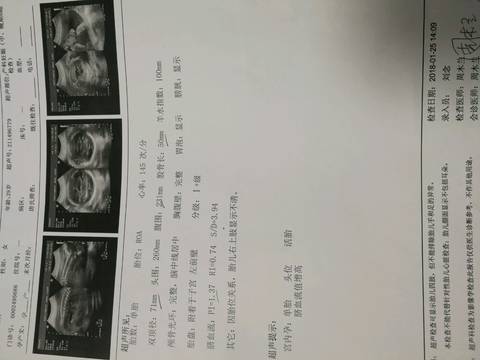 journal_insert_pic_941246782