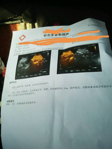 journal_insert_pic_940935670