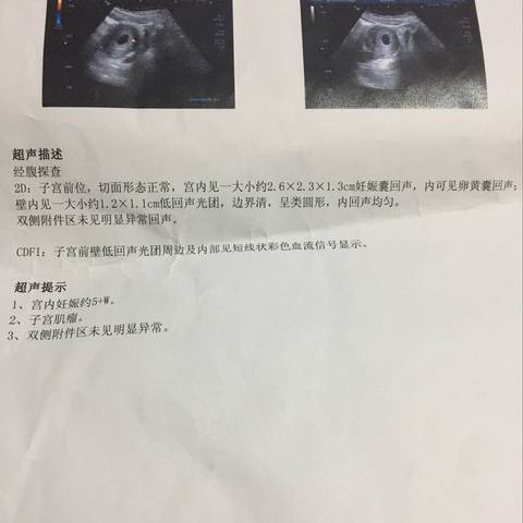 journal_insert_pic_941076968