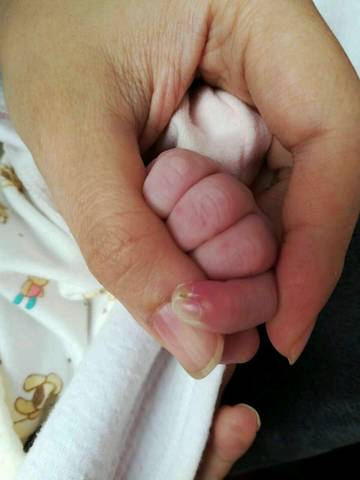 宝宝四五天的时候手指长了一个脓包怎麼回事