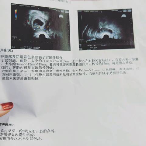 journal_insert_pic_952218707