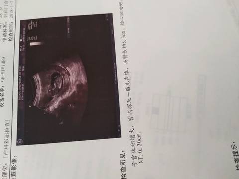 journal_insert_pic_955031869