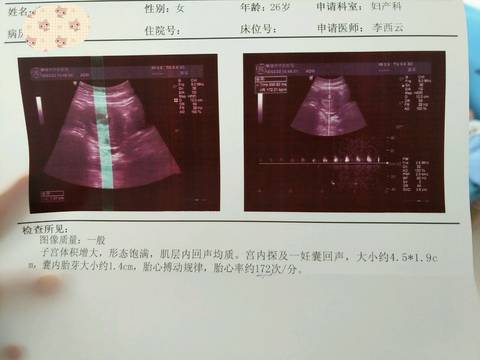 journal_insert_pic_955808775