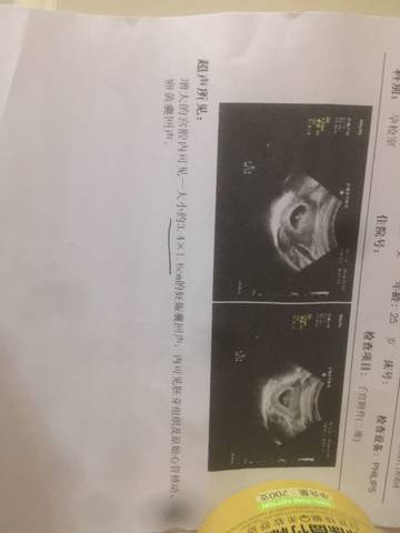 journal_insert_pic_956381650