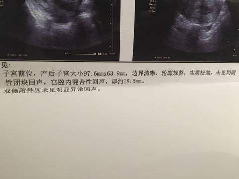 journal_insert_pic_958127998