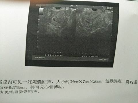 journal_insert_pic_959972086