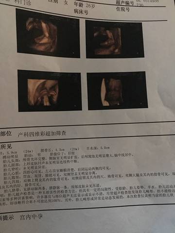 journal_insert_pic_961322172