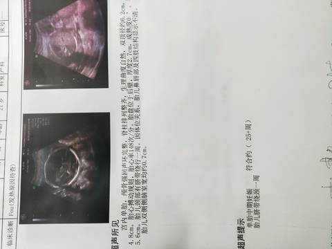 journal_insert_pic_961288762