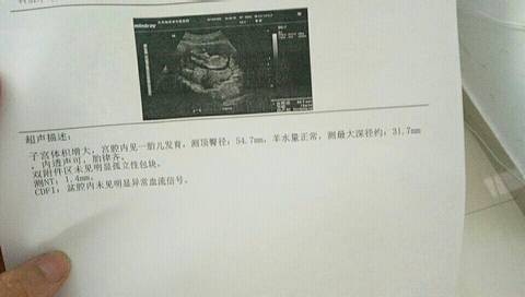 journal_insert_pic_962006914