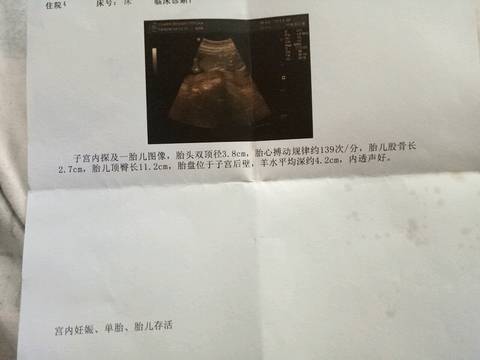 journal_insert_pic_962659507