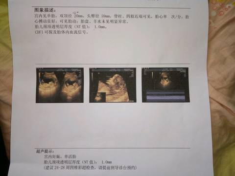 journal_insert_pic_963432301
