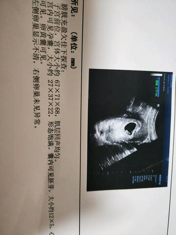 journal_insert_pic_964751225