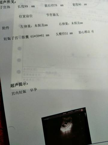 journal_insert_pic_966005352