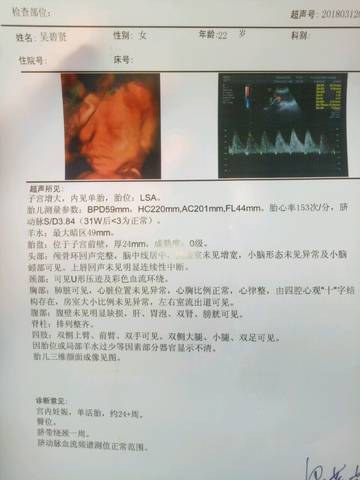 journal_insert_pic_966759215