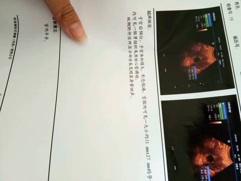 journal_insert_pic_967993761