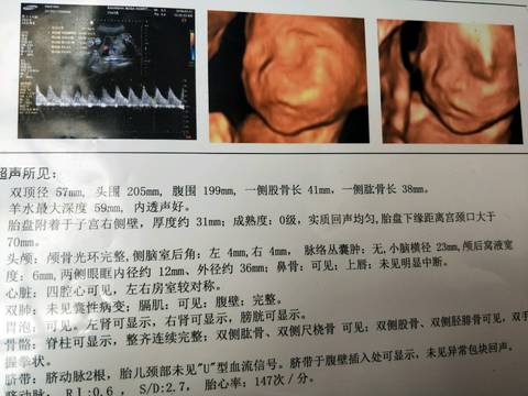 journal_insert_pic_968811821