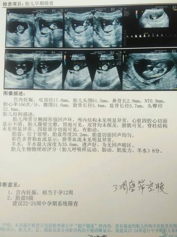 journal_insert_pic_969406063