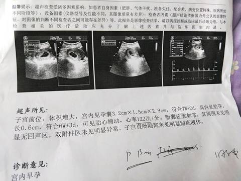 journal_insert_pic_971728179