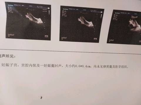 journal_insert_pic_972991884