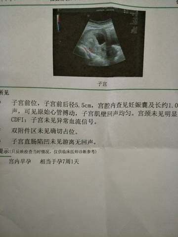 journal_insert_pic_973202143