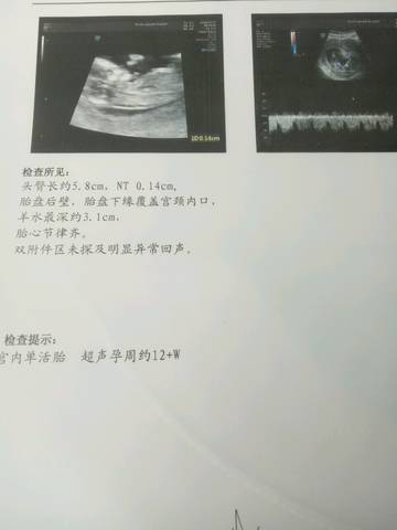 journal_insert_pic_972977133