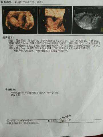 journal_insert_pic_973863962