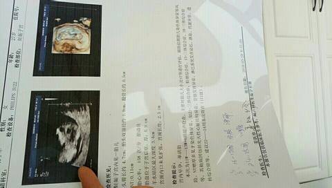 journal_insert_pic_977794944