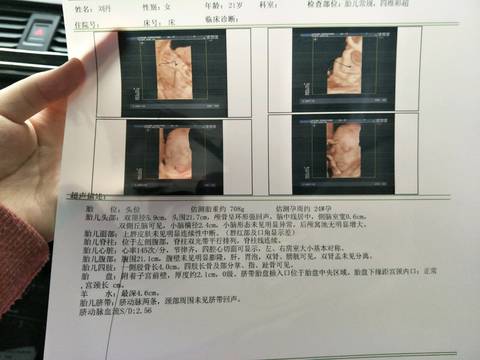 journal_insert_pic_978342581