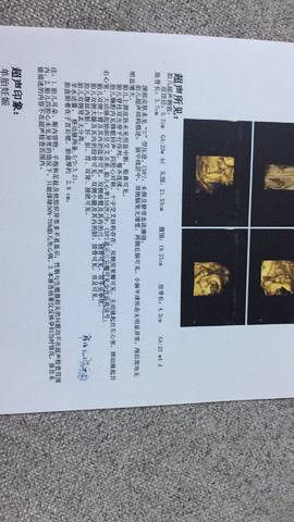 journal_insert_pic_979082423