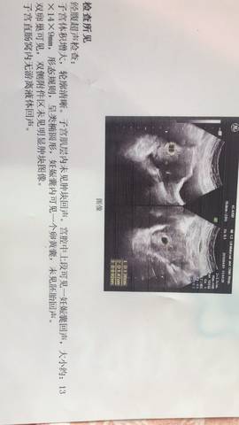 journal_insert_pic_979990293