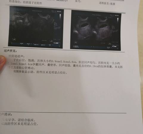 journal_insert_pic_980913386