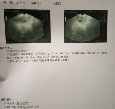 journal_insert_pic_980913347