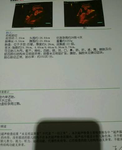 journal_insert_pic_980986573