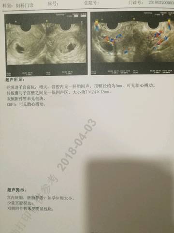 journal_insert_pic_981613760