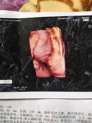 journal_insert_pic_982942716