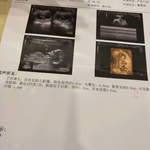 journal_insert_pic_982909359
