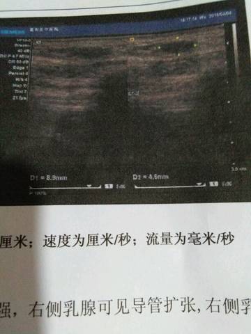 journal_insert_pic_986902641