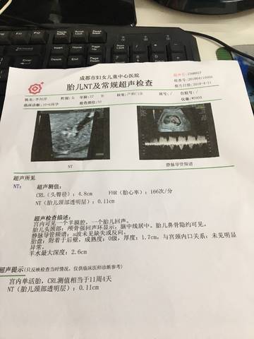 journal_insert_pic_987434895