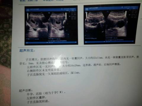 journal_insert_pic_988750992