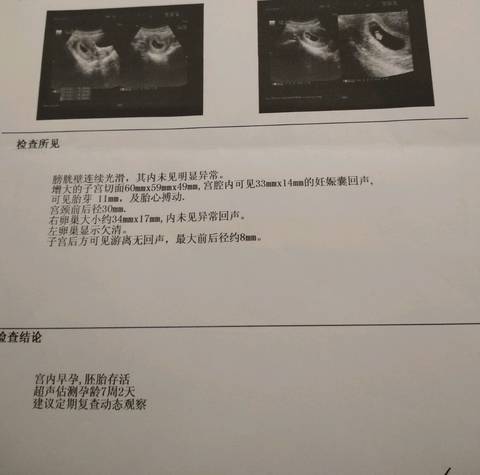 journal_insert_pic_989544225