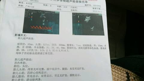 journal_insert_pic_990941625