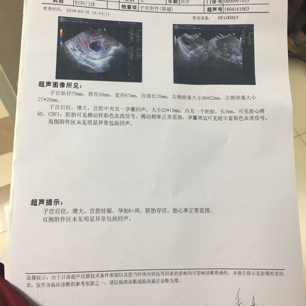 忘记末次月经日期，今天彩超有胎心胎芽