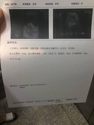 journal_insert_pic_991628210