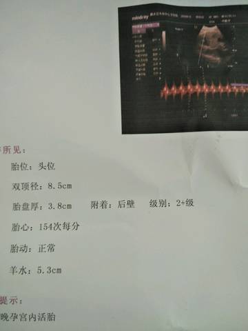 journal_insert_pic_992585173