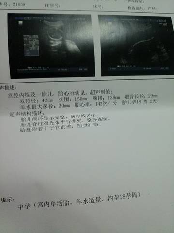 journal_insert_pic_992824020