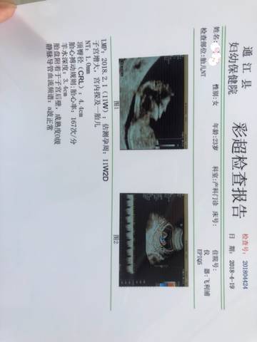 journal_insert_pic_993040938
