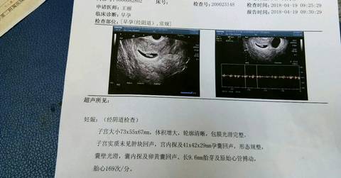 journal_insert_pic_993011246