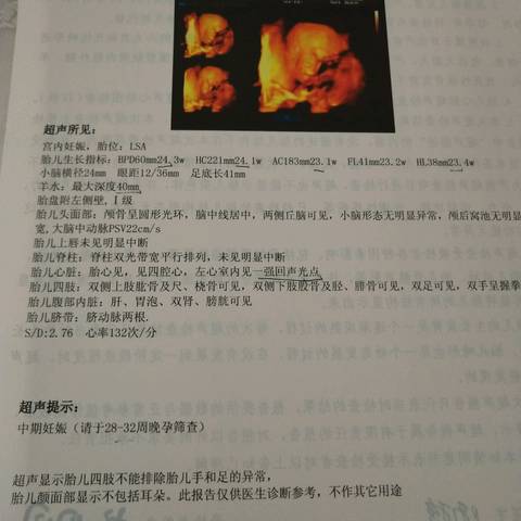 journal_insert_pic_995216026
