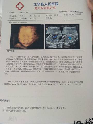 journal_insert_pic_996147478